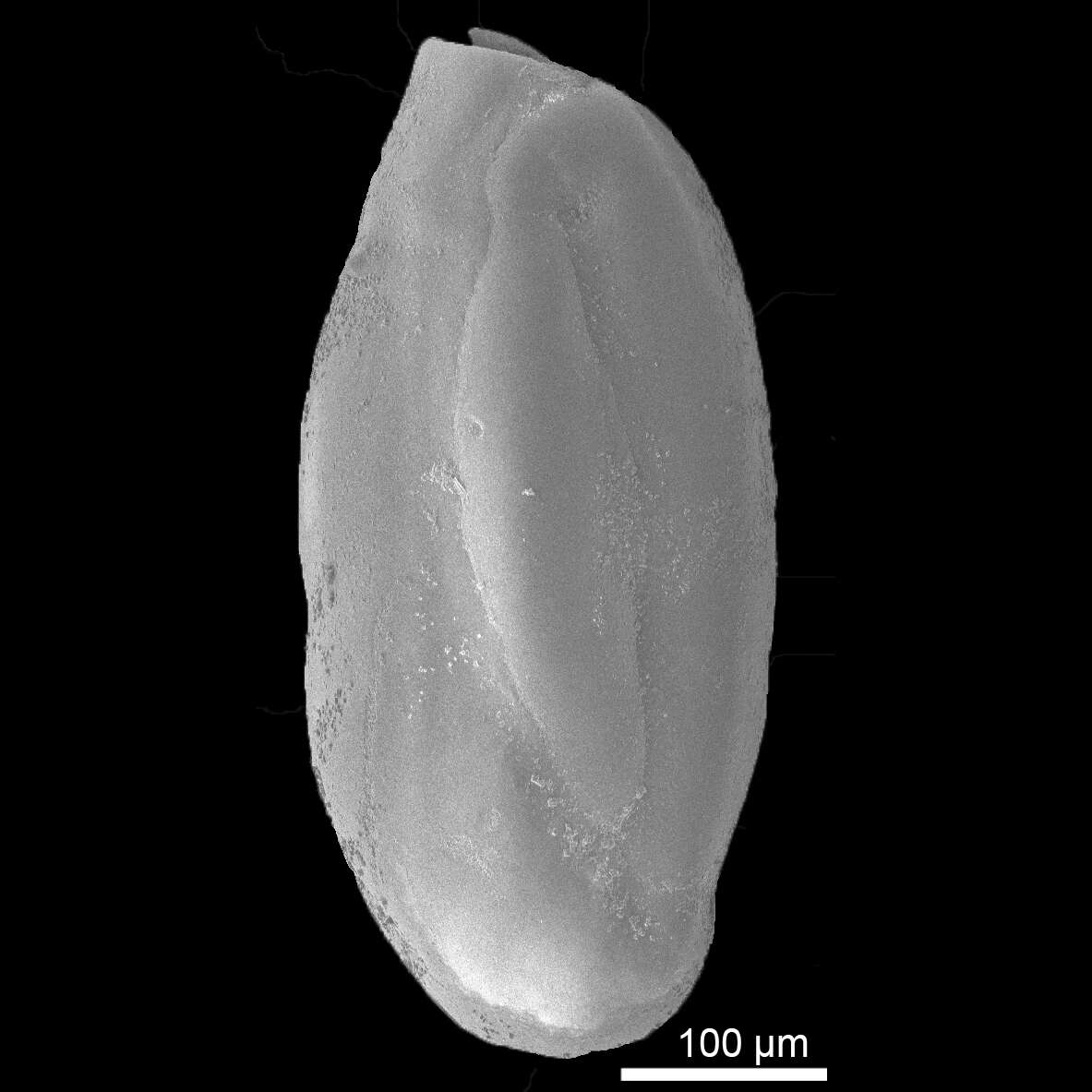 Image of Quinqueloculina seminuda Reuss 1866