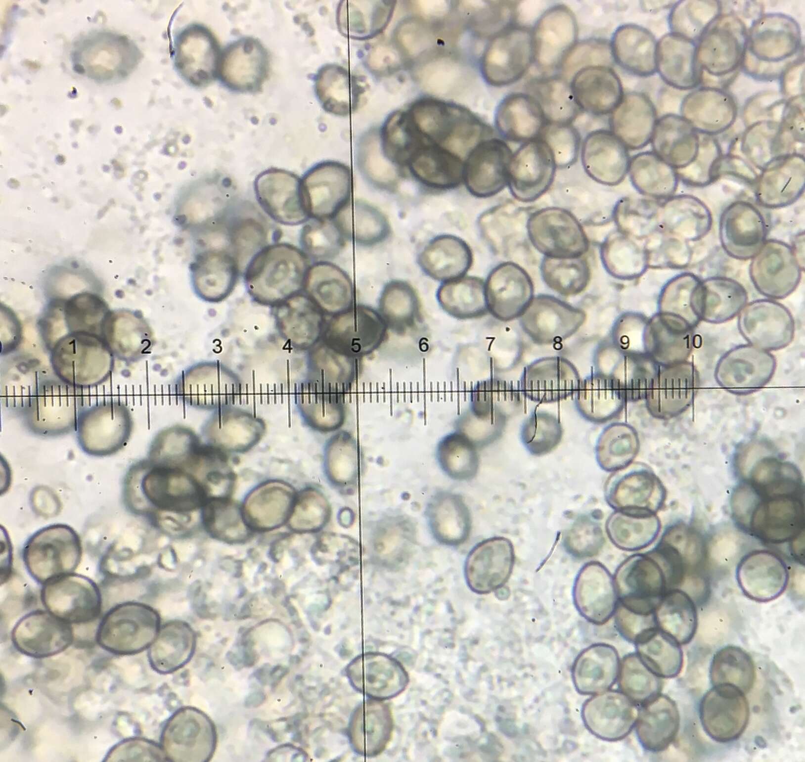 Image of Chaetomium globosum Kunze 1817