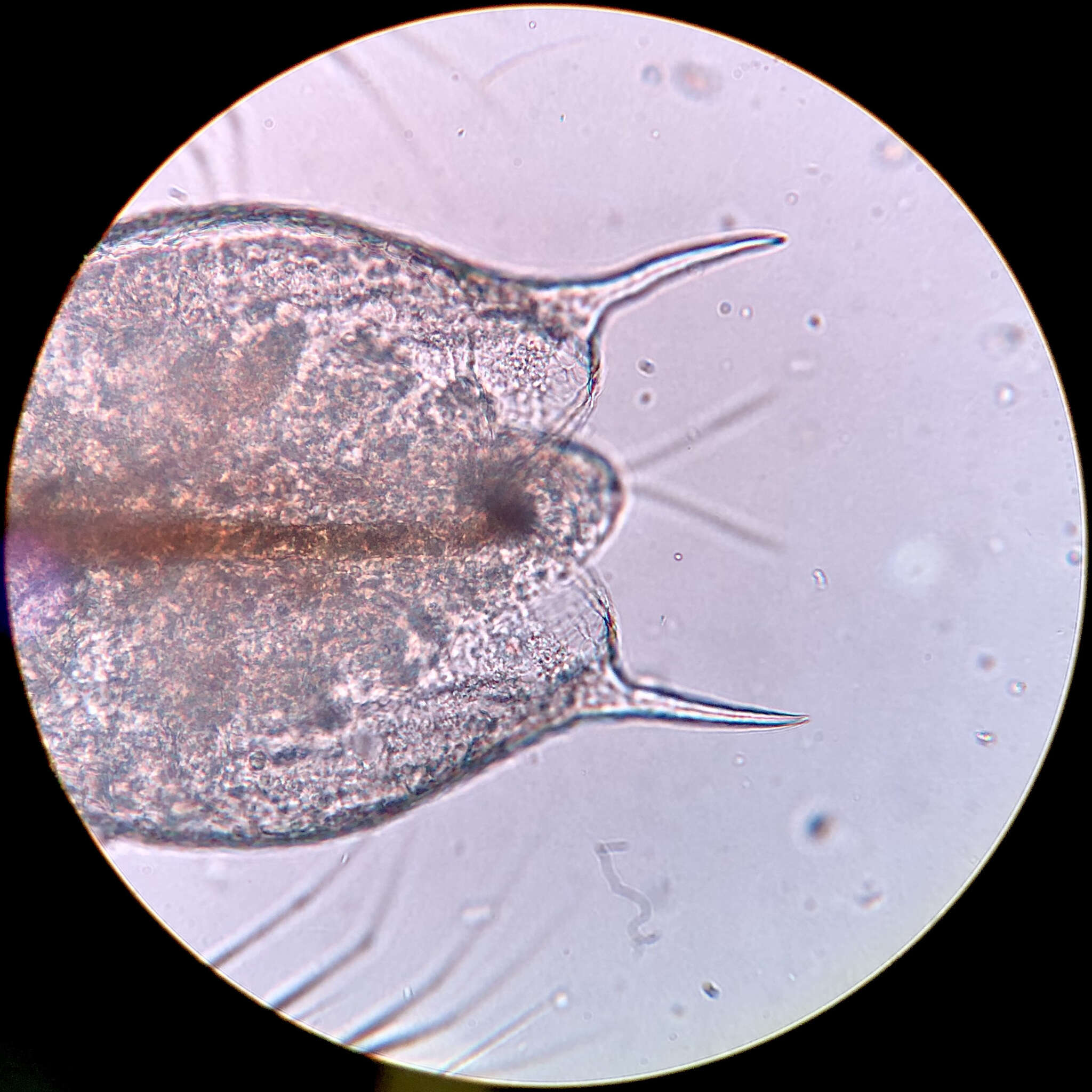 Image of meniscus waterflea