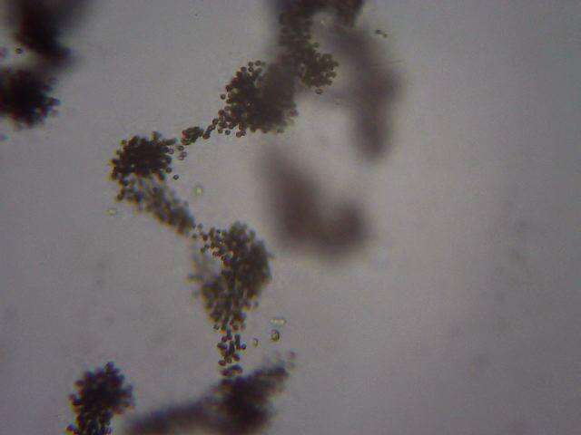 Image of Microcystis