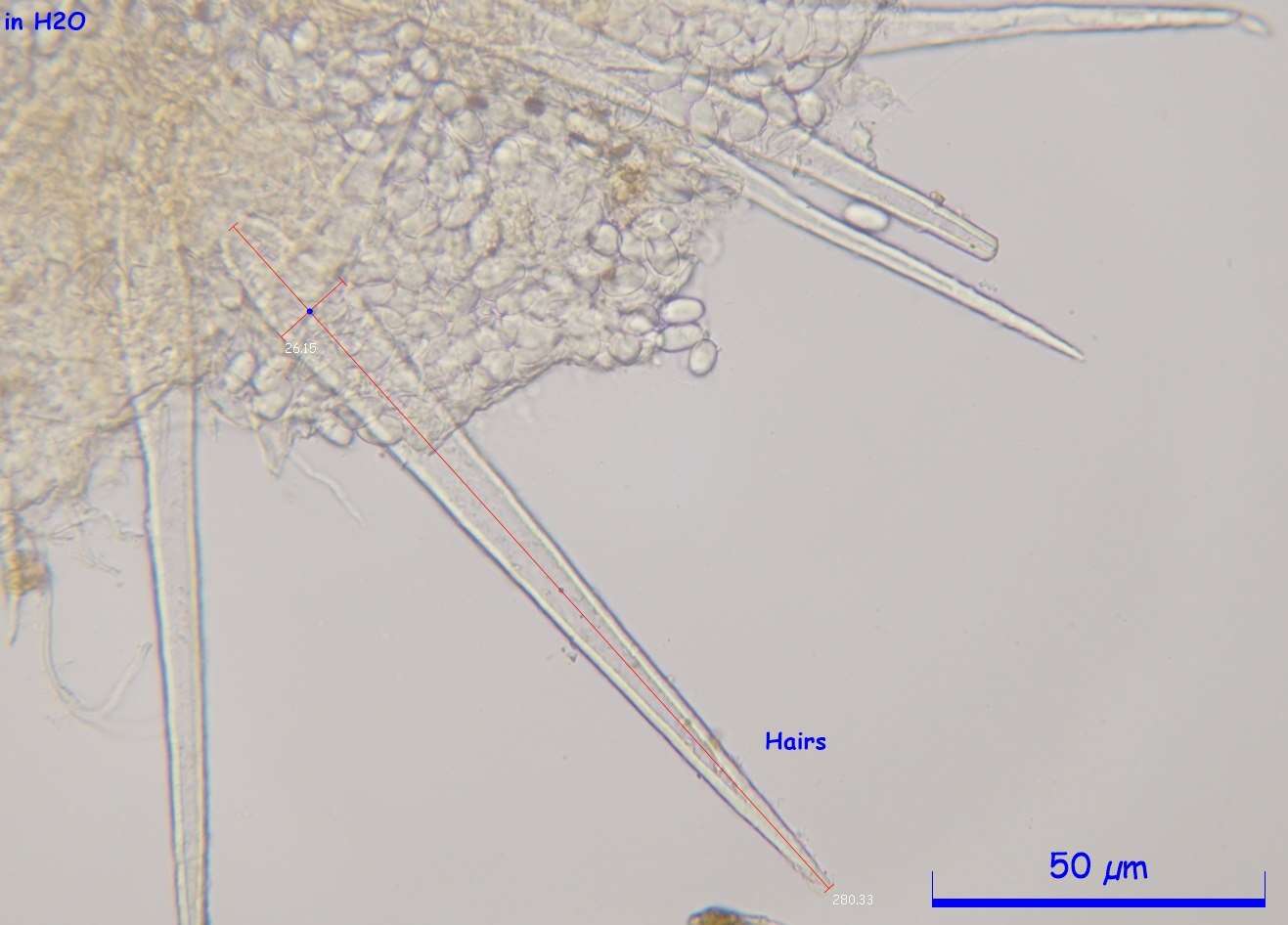 Image de Lasiobolus intermedius J. L. Bezerra & Kimbr. 1975