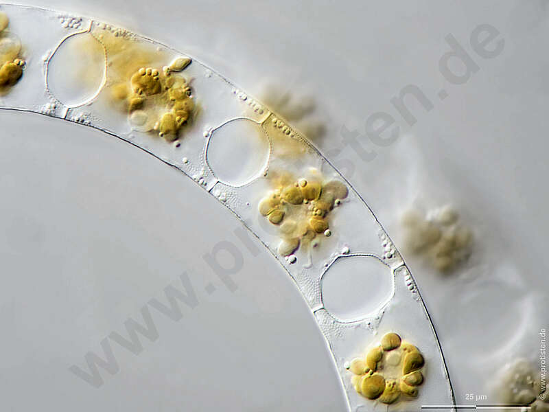 Image of Eucampia zodiacus