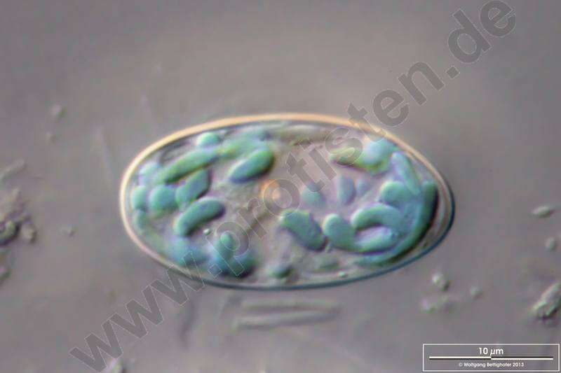 Image de Glaucocystales