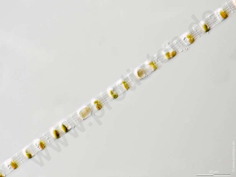 Image of Skeletonema costatum