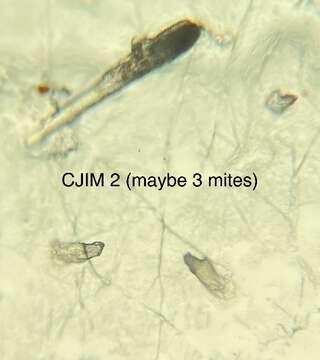 Image of Follicle mites