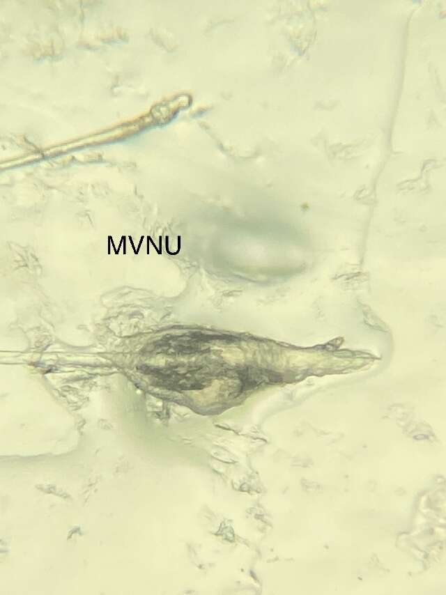 Image of Follicle mites