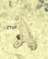 Image of Follicle mites