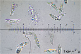 Image of Ascocoryne sarcoides (Jacq.) J. W. Groves & D. E. Wilson 1967