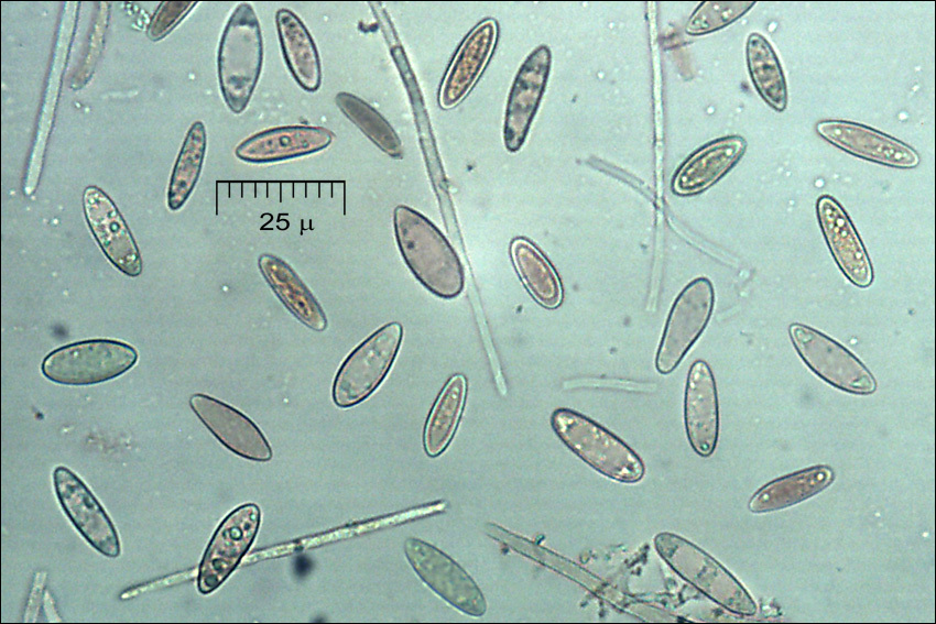 Image of Lachnellula occidentalis (G. G. Hahn & Ayers) Dharne 1965