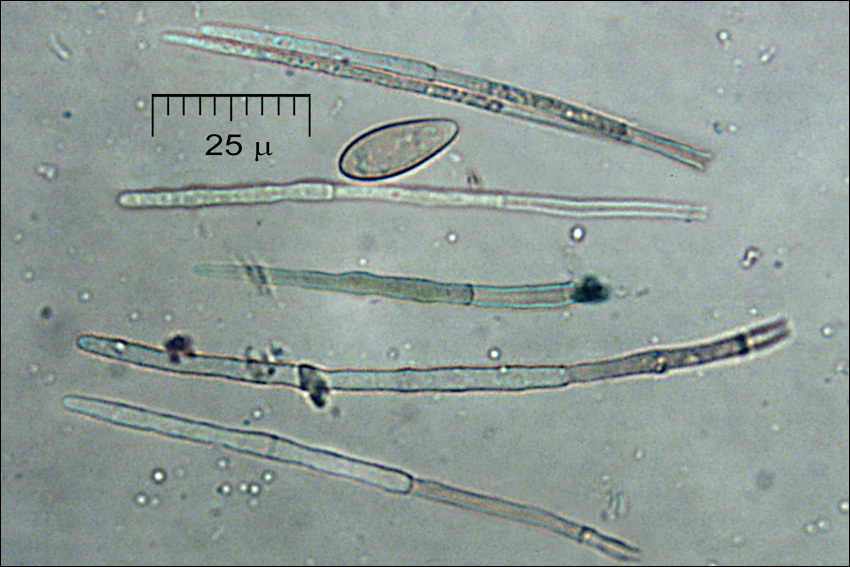 Image of Lachnellula occidentalis (G. G. Hahn & Ayers) Dharne 1965