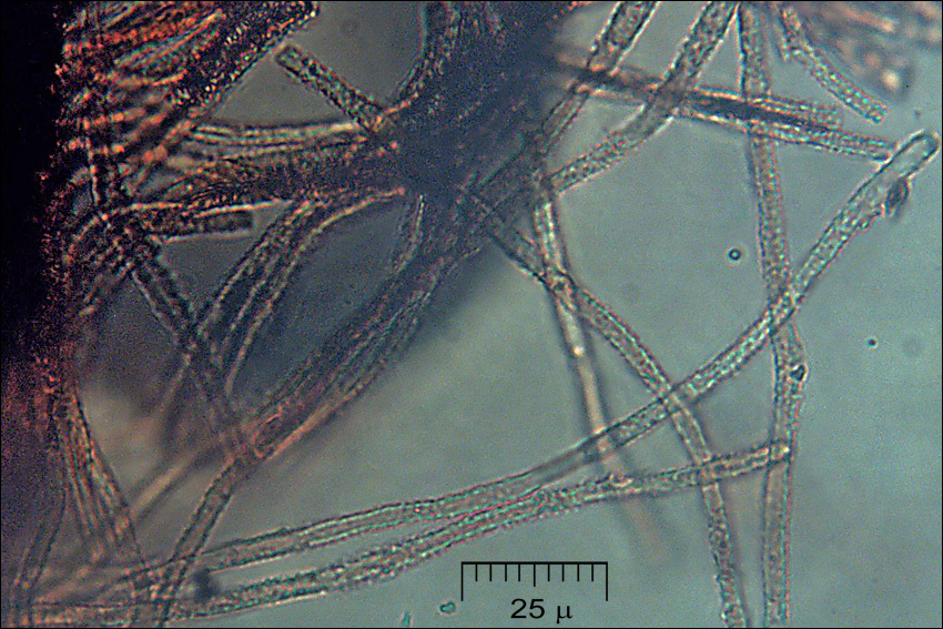 Imagem de Lachnellula occidentalis (G. G. Hahn & Ayers) Dharne 1965