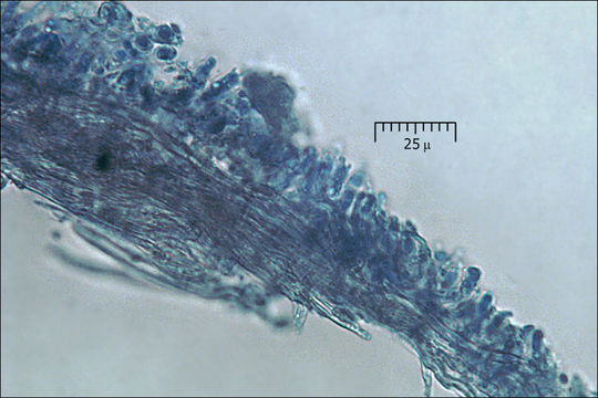 Cinereomyces lindbladii (Berk.) Jülich 1982 resmi