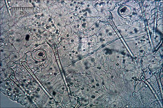 Imagem de Cinereomyces lindbladii (Berk.) Jülich 1982