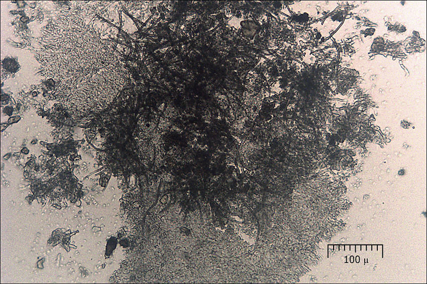 Image of Clonostachys rosea (Link) Schroers, Samuels, Seifert & W. Gams 1999