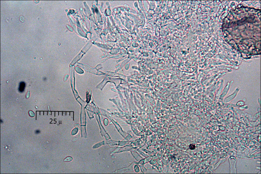 Image de Clonostachys rosea (Link) Schroers, Samuels, Seifert & W. Gams 1999