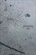 Image of Clonostachys rosea (Link) Schroers, Samuels, Seifert & W. Gams 1999