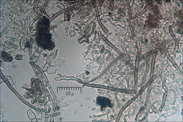 Image de Clonostachys rosea (Link) Schroers, Samuels, Seifert & W. Gams 1999