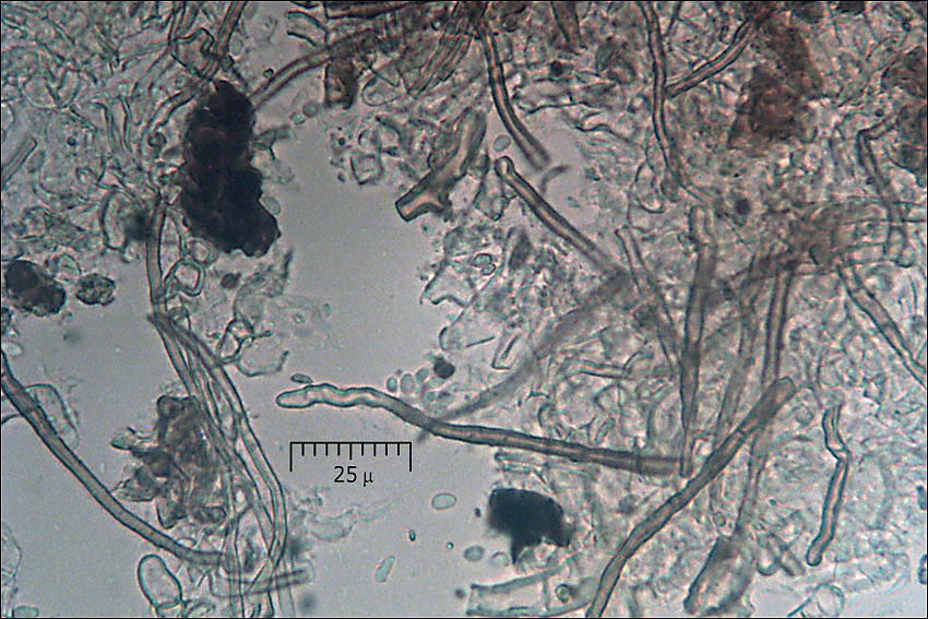 Image de Clonostachys rosea (Link) Schroers, Samuels, Seifert & W. Gams 1999