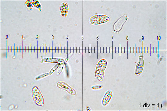 Image de Guepiniopsis buccina (Pers.) L. L. Kenn. 1959