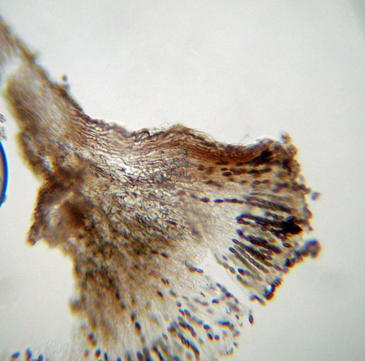 Image of mycocalicium lichen
