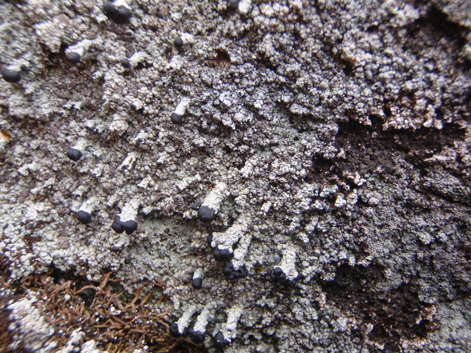 Image of nail lichen