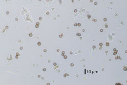 Image of <i>Chaenotheca ferruginea</i>