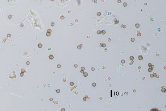 Image of <i>Chaenotheca ferruginea</i>