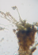 Image of Ahlner's microcalicium lichen