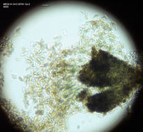 Image of microcalicium lichen
