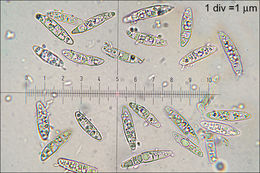 Image of Ascocoryne cylichnium (Tul.) Korf 1971