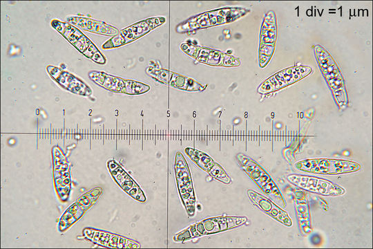 صورة Ascocoryne cylichnium (Tul.) Korf 1971