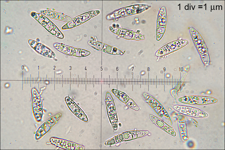 Image of Ascocoryne cylichnium (Tul.) Korf 1971