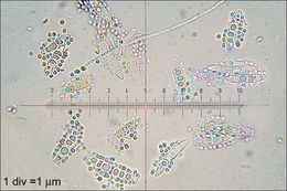 Image of Ascocoryne cylichnium (Tul.) Korf 1971