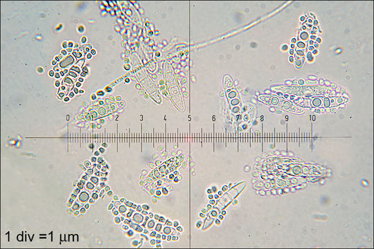 صورة Ascocoryne cylichnium (Tul.) Korf 1971