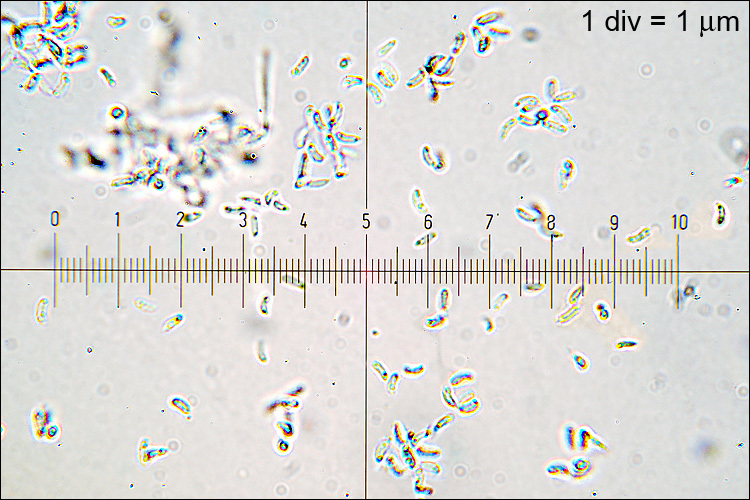 Image of Ascocoryne cylichnium (Tul.) Korf 1971