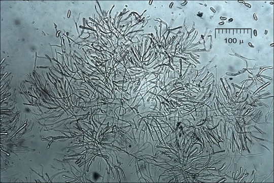 Image of Dacrymyces chrysospermus Berk. & M. A. Curtis 1873