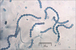 Image of <i>Collema crispum</i>