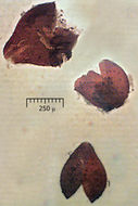 Image de Cosmospora coccinea Rabenh. 1862