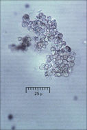 Image of Cosmospora coccinea Rabenh. 1862