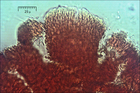 Image de Cosmospora coccinea Rabenh. 1862