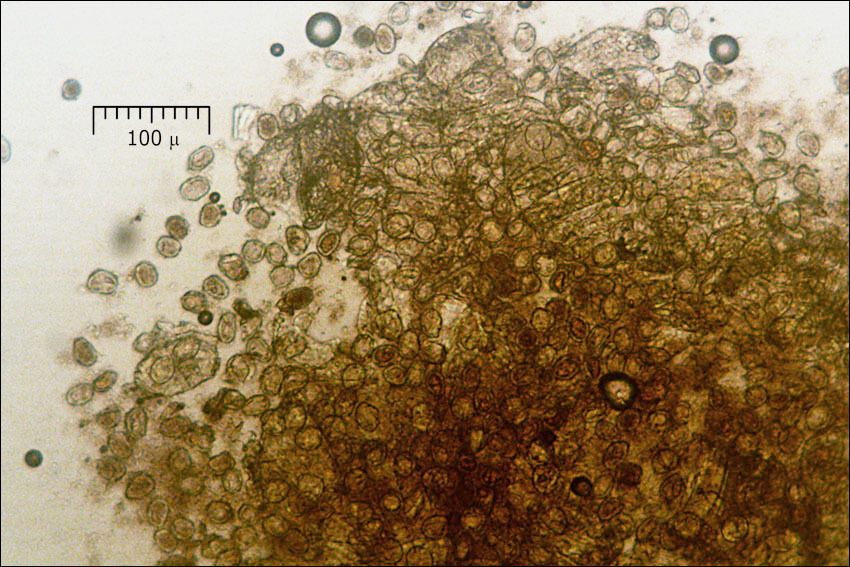 صورة Phragmidium mucronatum (Pers.) Schltdl. 1824