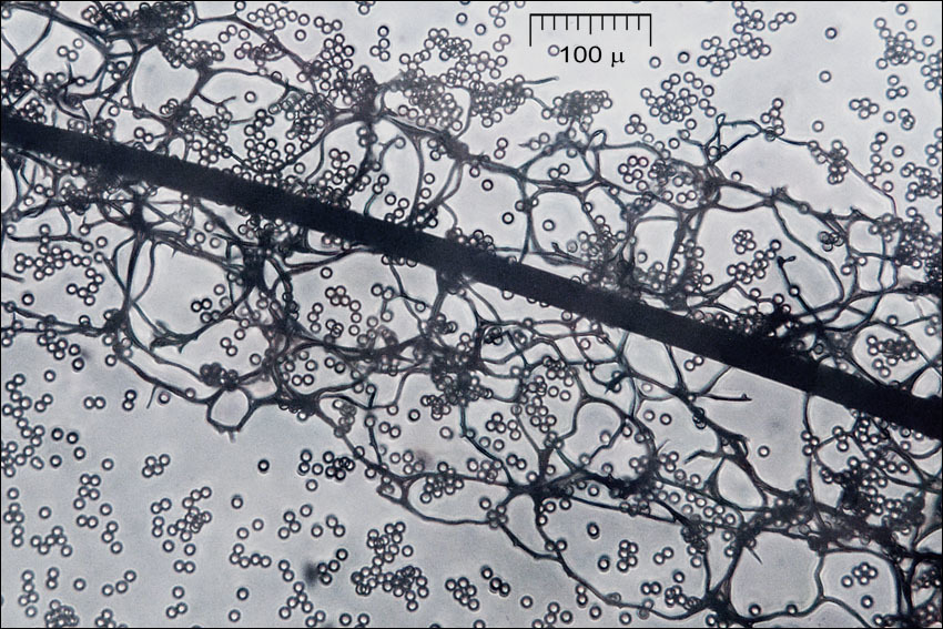 Image of Stemonitis flavogenita