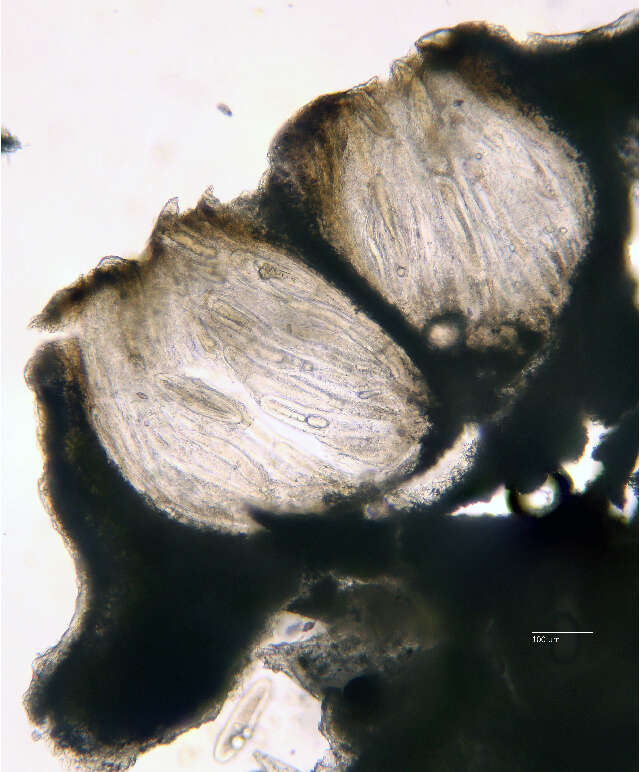 Image of Pertusariaceae