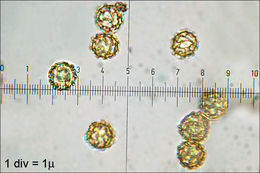 Image of Pretzel slime mold