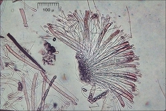 Image de Humaria hemisphaerica (F. H. Wigg.) Fuckel 1870