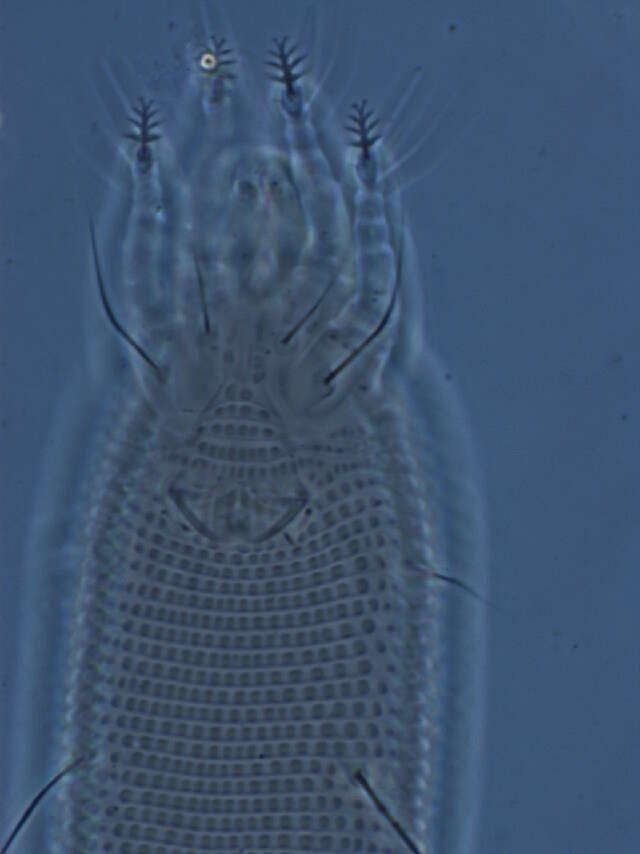 Image de Eriophyoidea