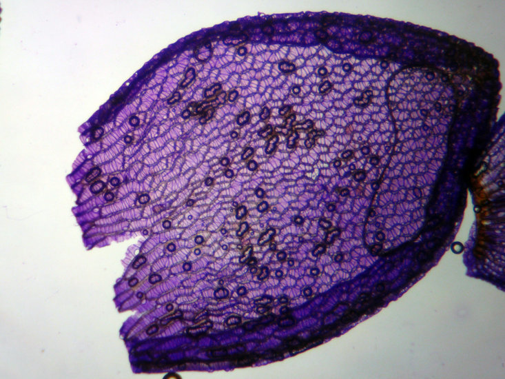 Image of papillose sphagnum