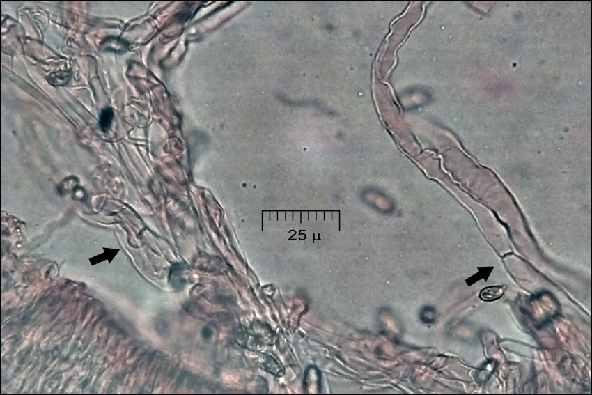 Image of Ramaria neoformosa R. H. Petersen 1976