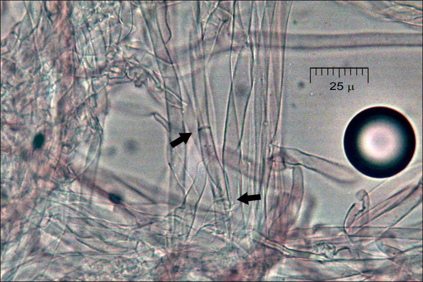 Image of Ramaria neoformosa R. H. Petersen 1976