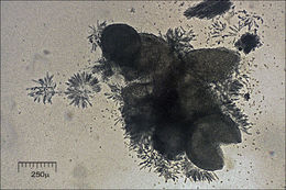 Image of Nectria peziza (Tode) Fr. 1849